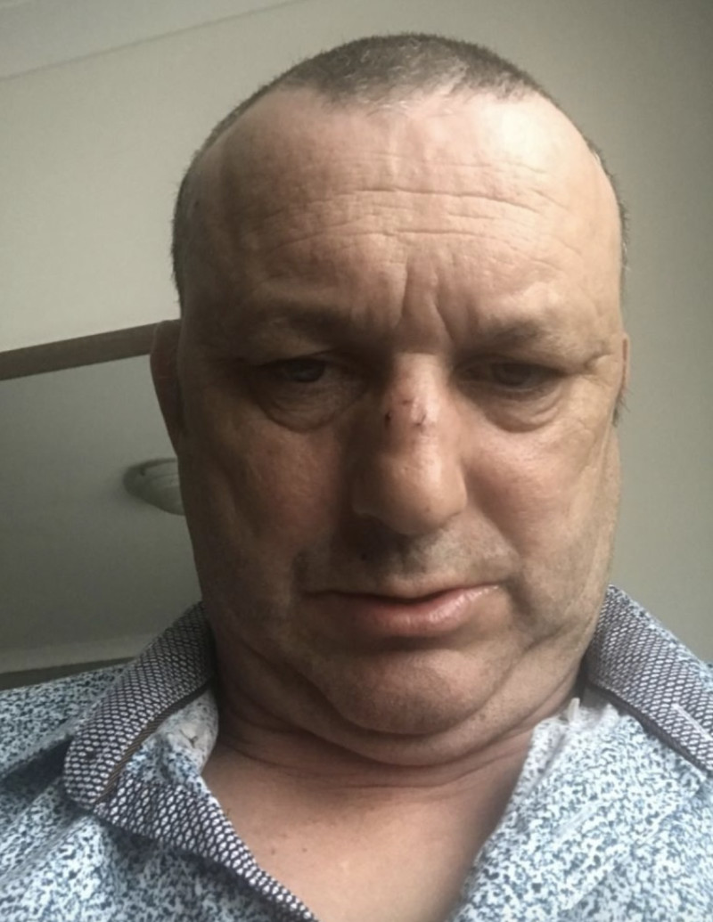 Other image for Pro darts star attacked in town by football fan
